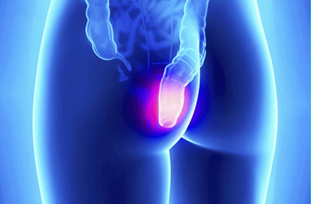 Gelarex poate fi utilizat atât extern, cât și rectal